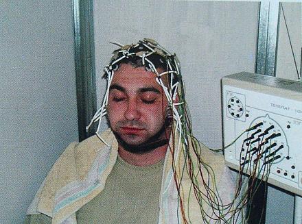 Нажмите на изображение для увеличения
Название: Реоэнцефалография.jpg
Просмотры: 1082
Размер: 152.4 Кб
ID: 16259