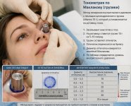 РўРѕРЅРѕРјРµС‚СЂРёСЏ СЃ РіСЂСѓР·РёРєР°РјРё РЅР° РіР»Р°Р·.jpg